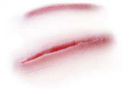 people & scars free transparent png image.
