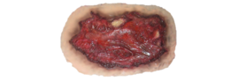 people & Wounds free transparent png image.