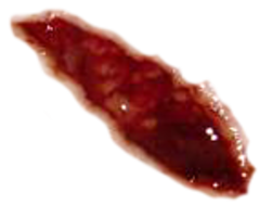 people & wounds free transparent png image.