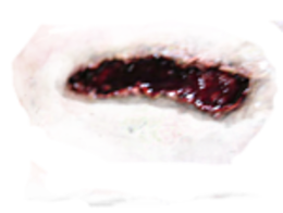 people & Wounds free transparent png image.